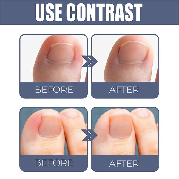 xr:d:DAFnShMX0Og:3,j:8746385519169695807,t:23063010