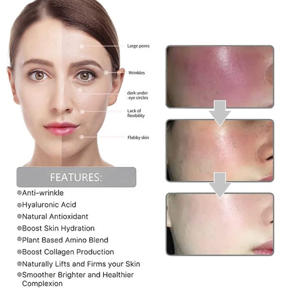 xr:d:DAFm3MpEoMU:3,j:1563143644873860445,t:23062520